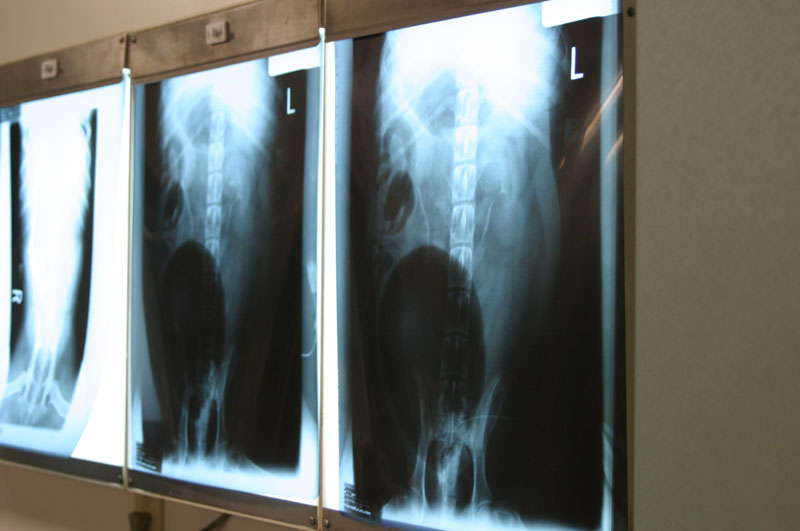X-Rays X-Rays